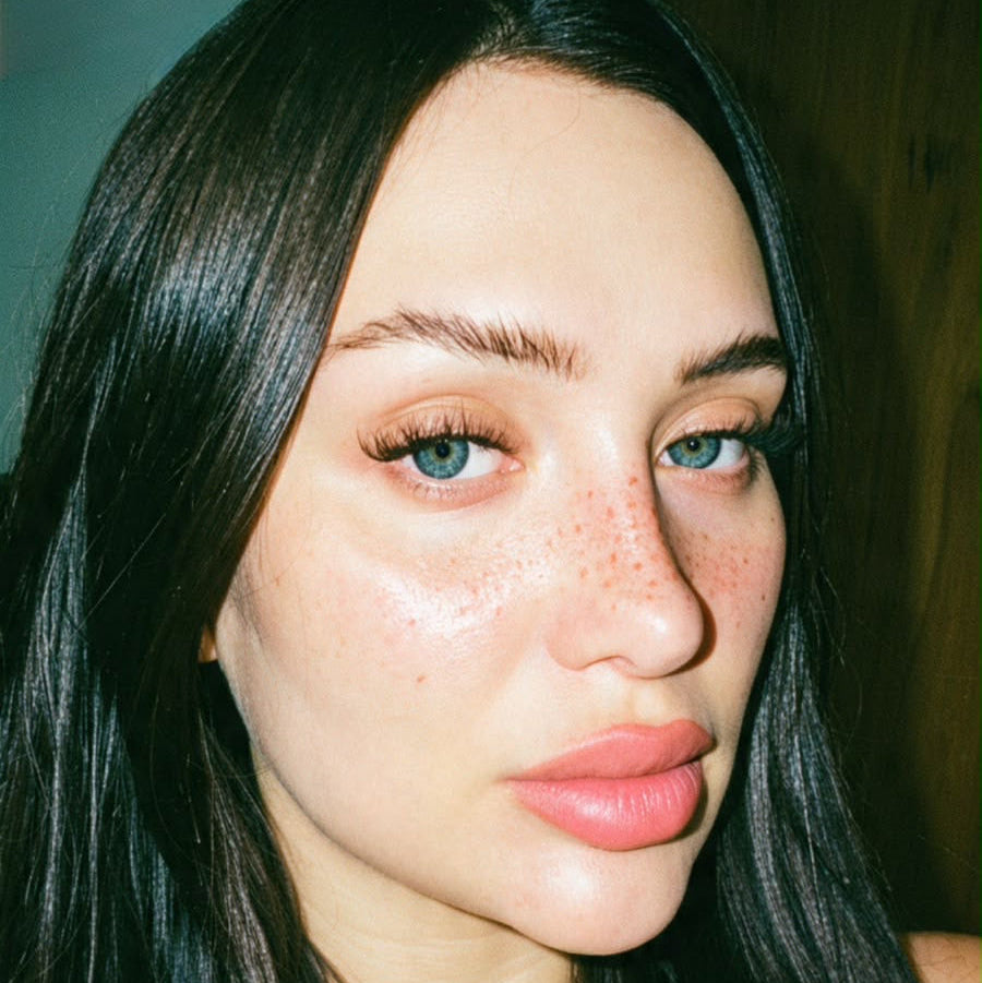 Micropigmentación de pecas