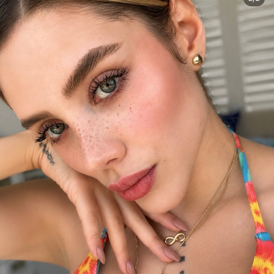Micropigmentación de pecas