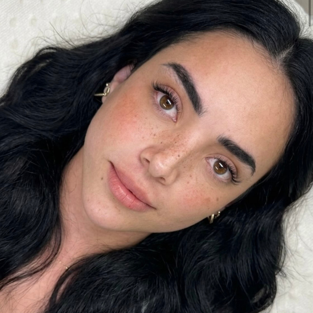 Micropigmentación de pecas